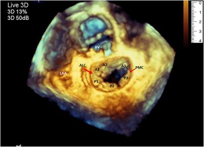Three-dimensional printing of mitral valve models using echocardiographic data improves the knowledge of cardiology fellow physicians in training